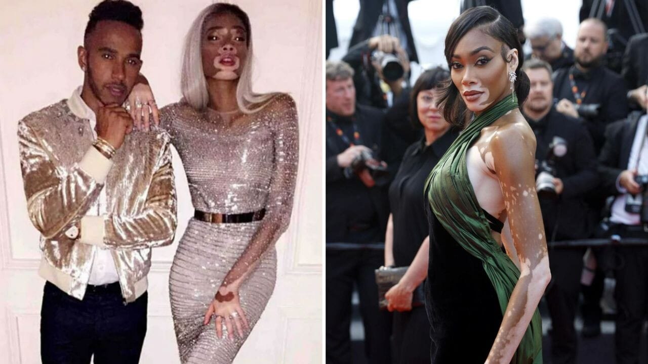 Dal 2017 al 2019 è stato il turno di un'altra modella: Winnie Harlow. Quest'ultima è riuscita ad affermarsi nel mondo della moda nonostante la sua malattia, la vitiligine, che provoca la comparsa sulla cute di chiazze non pigmentate.