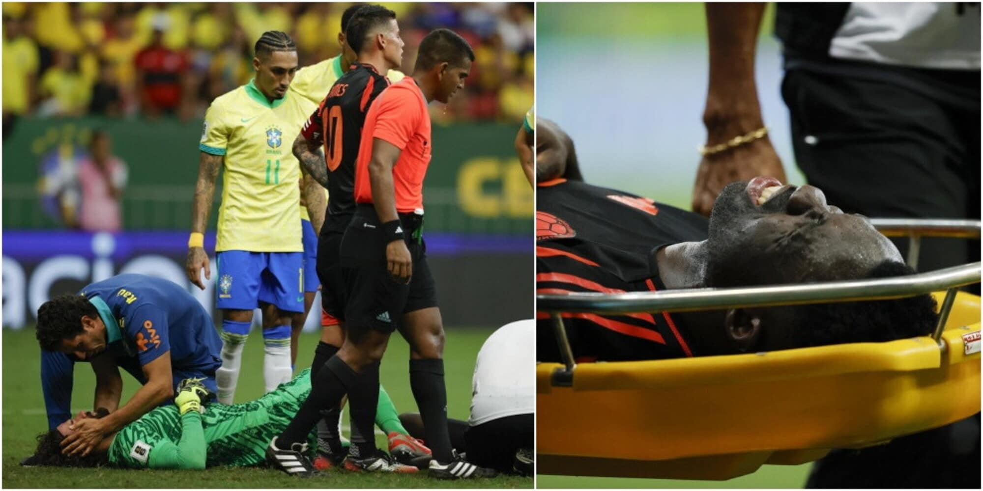 Scontro Alisson-Sanchez, paura in Brasile-Colombia: il difensore perde conoscenza