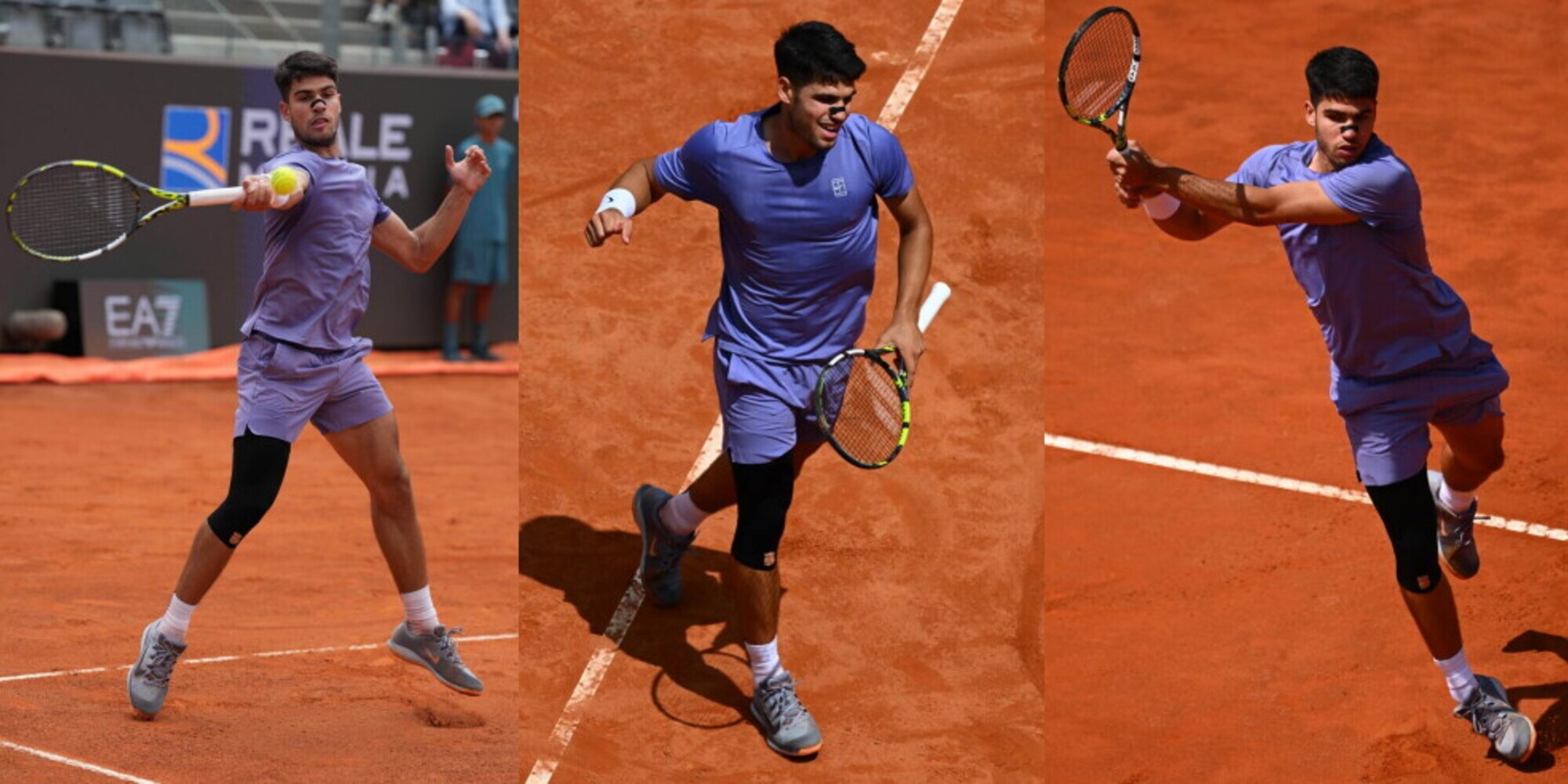 Alcaraz non si ferma: vince agli Internazionali con cerotto al naso e fasciatura alla gamba