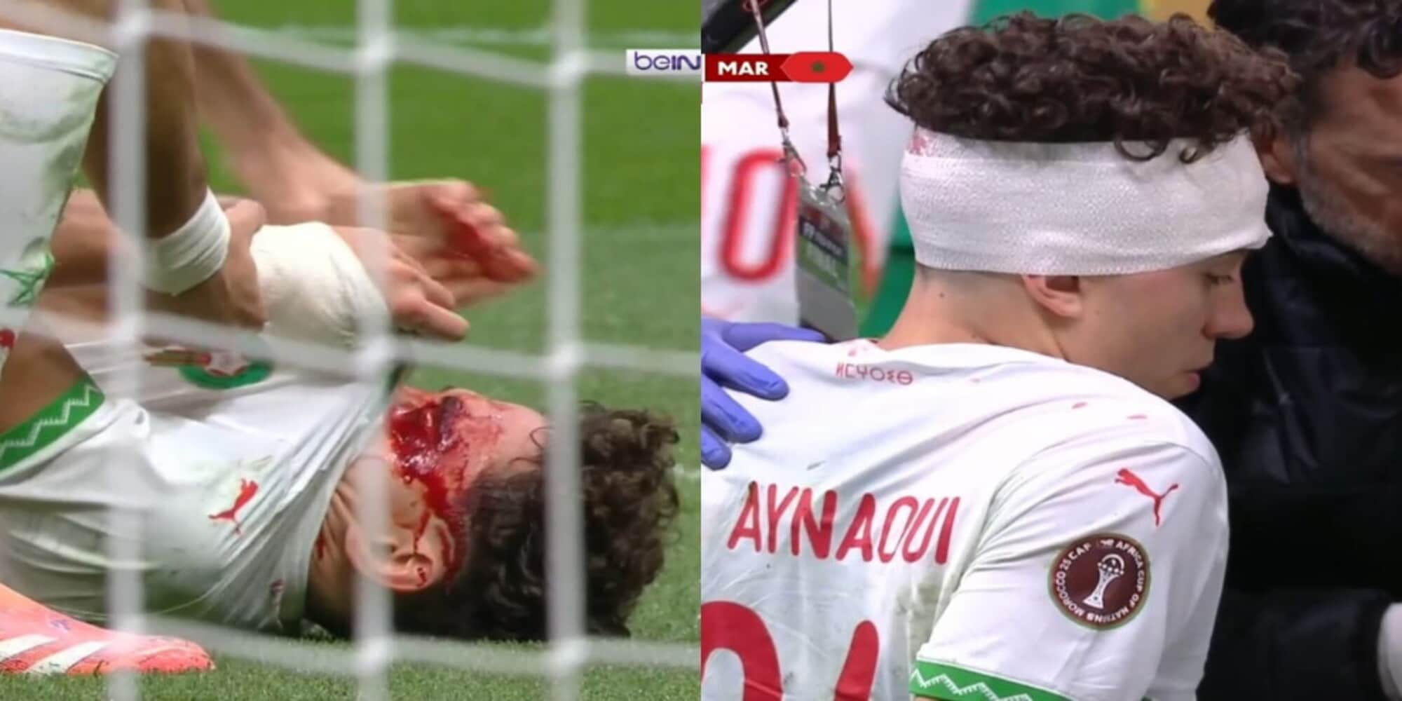 El Aynaoui, brutto scontro con Diouf: sangue e bendaggio in testa