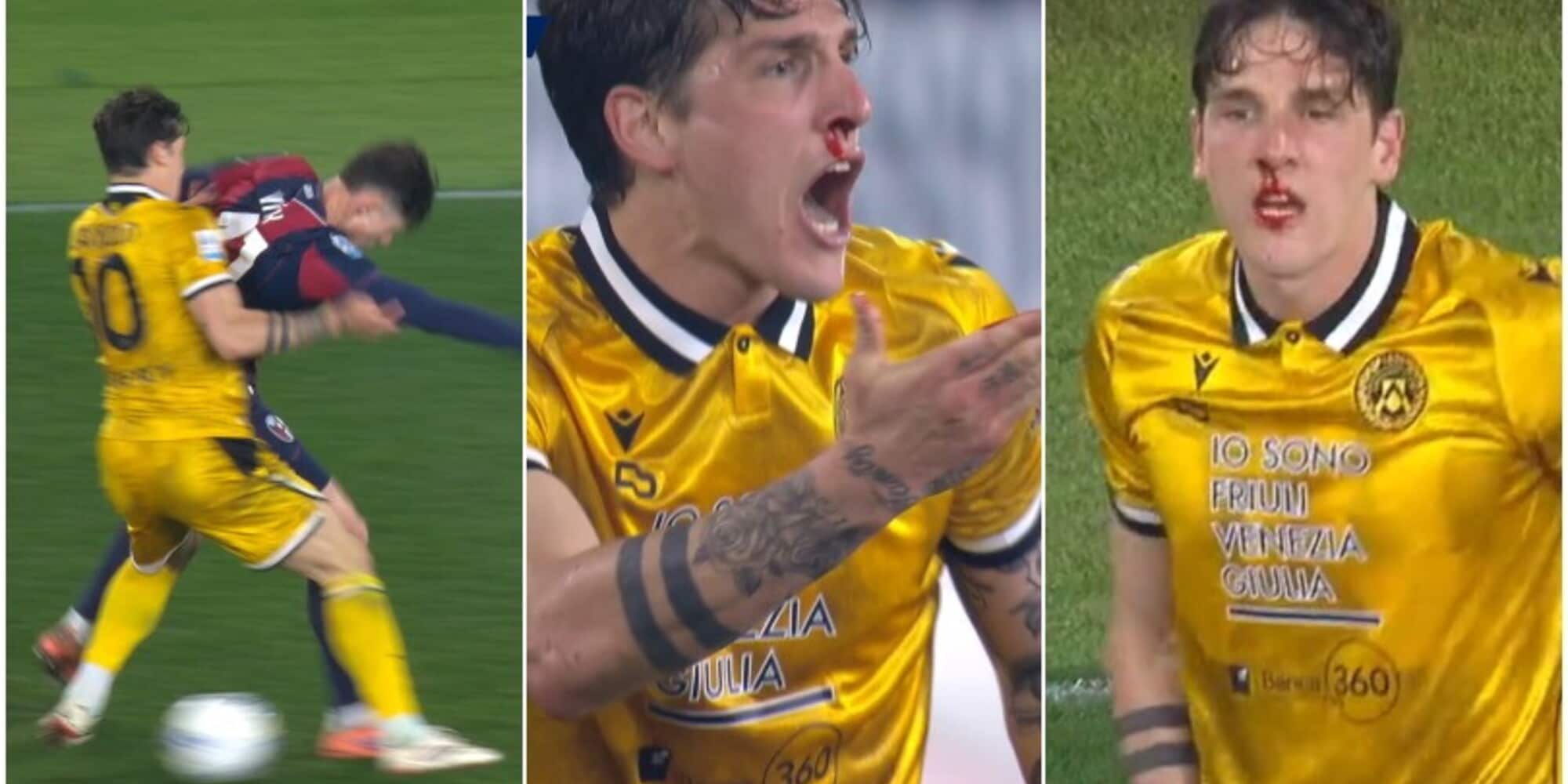 Zaniolo, sangue dal naso dopo una gomitata in faccia di Vitik: si accendono gli animi durante Bologna-Udinese  