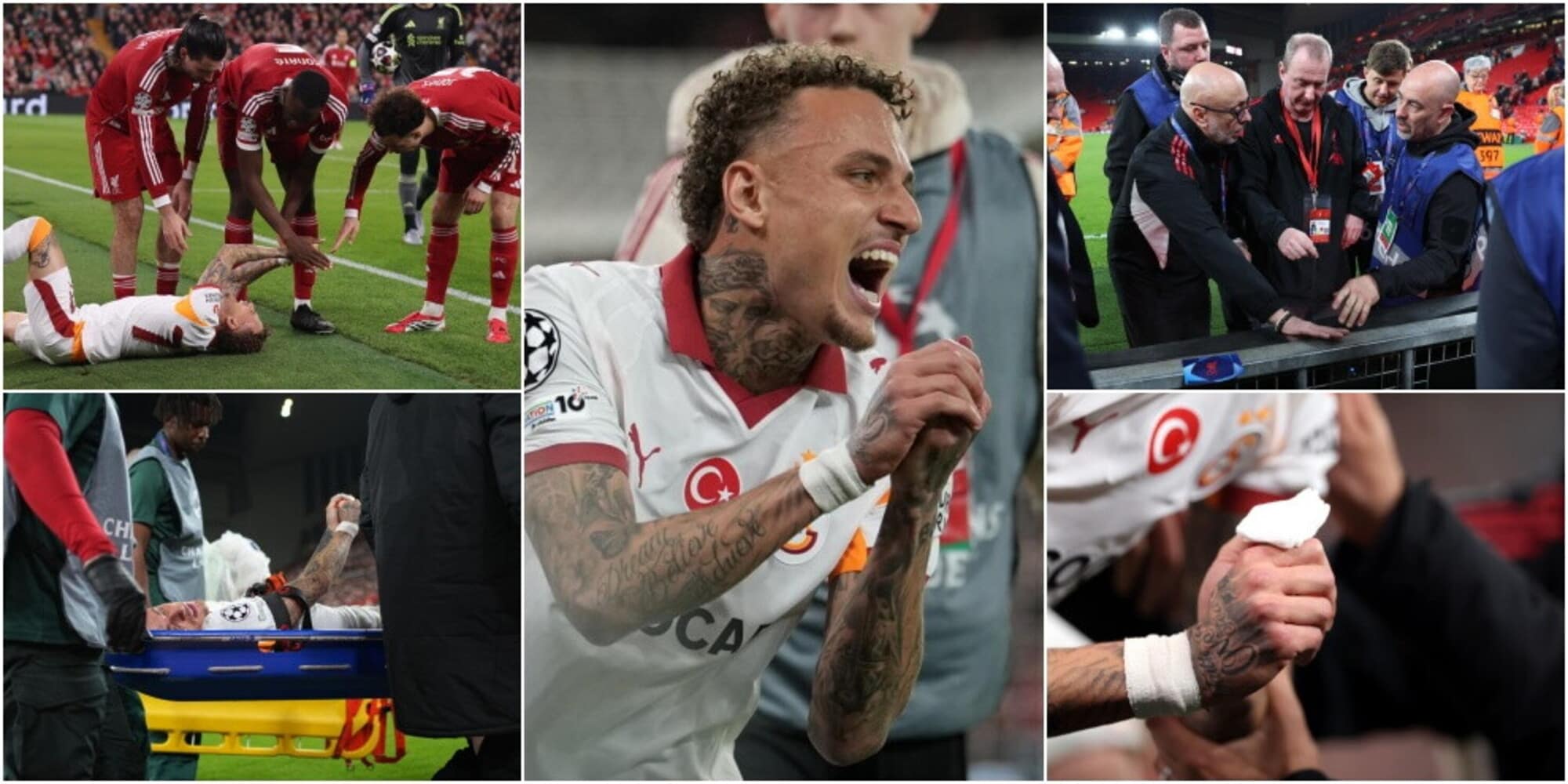 Infortunio shock per Lang durante Liverpool-Galatasaray: grave taglio a un dito per l'ex Napoli