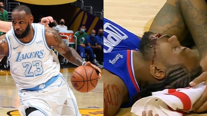 Nba, i Lakers battono i Mavericks. Paura per Kawhi Leonard