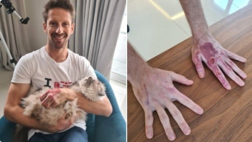 F1: Grosjean mostra le sue mani, non più fasciate, sui social