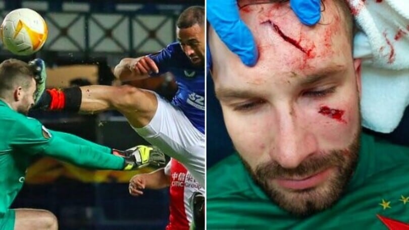 Rangers, entrata killer sul portiere: frattura al cranio!