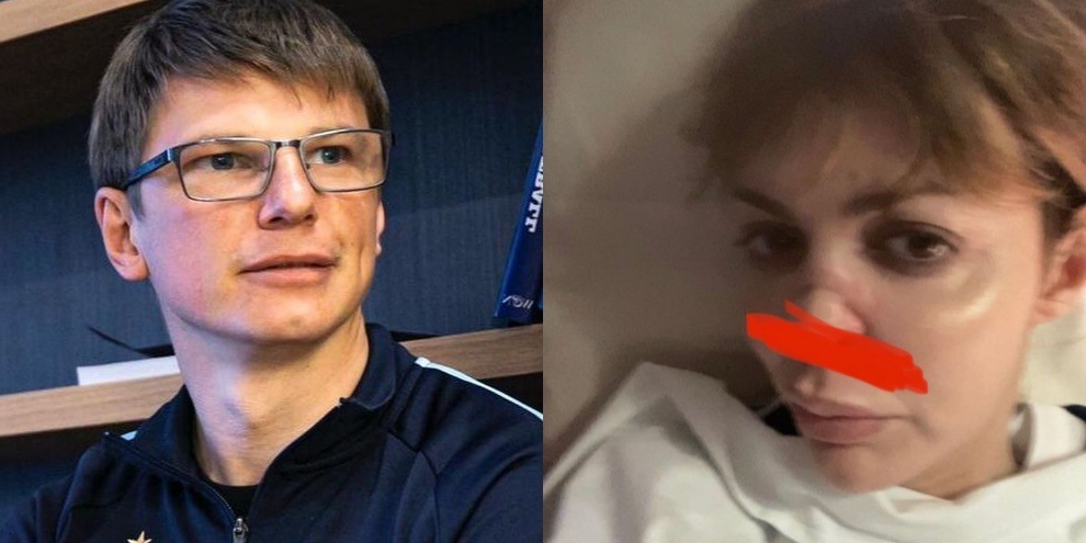 Dramma Arshavin, l'ex moglie è in fin di vita per il Covid