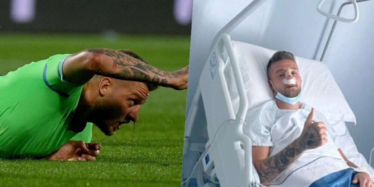 Lazio, Milinkovic operato: i tempi di recupero