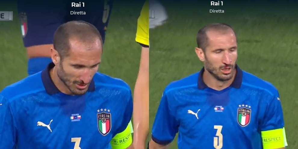 Italia-Repubblica Ceca, sangue dal naso per Chiellini