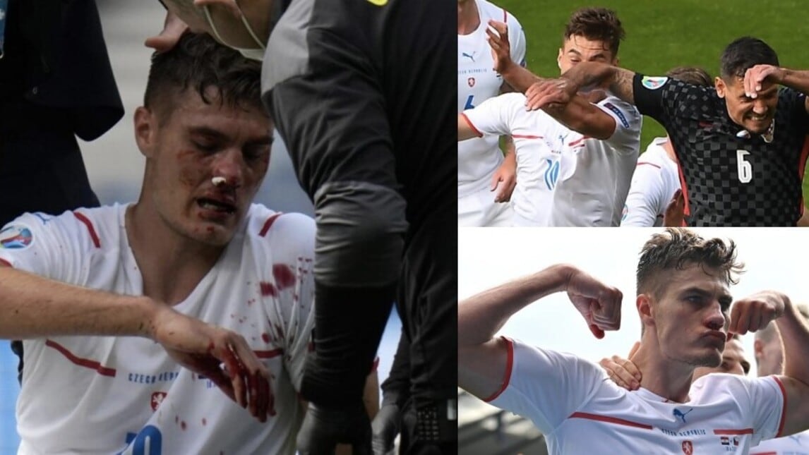 Schick, dolore e sangue: che gomitata da Lovren!