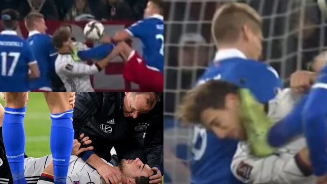 Goretzka shock: il fallo horror subito in Germania-Liechtenstein