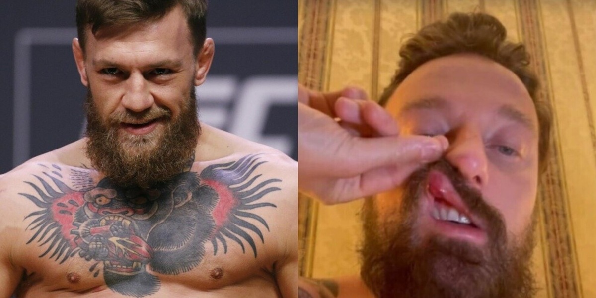 McGregor contro Facchinetti, la frase choc: "Se l'è meritato"
