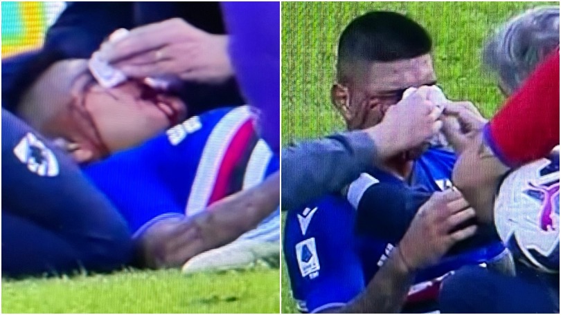 Amione è una maschera di sangue: scontro shock in Sampdoria-Fiorentina