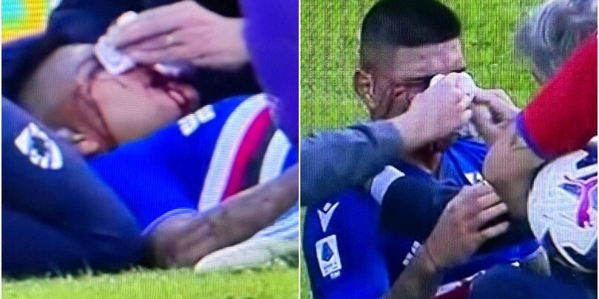 Amione, infortunio shock: è una maschera di sangue dopo un violento scontro in Sampdoria-Fiorentina