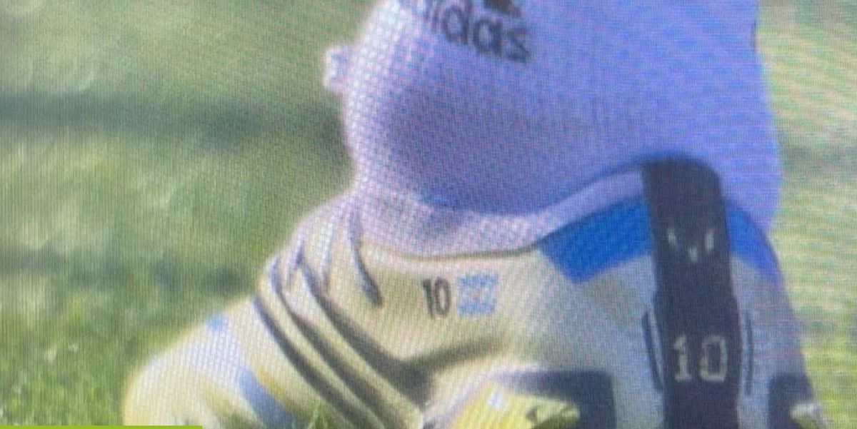 La foto della caviglia di Messi spaventa l'Argentina e i Mondiali: ecco come sta