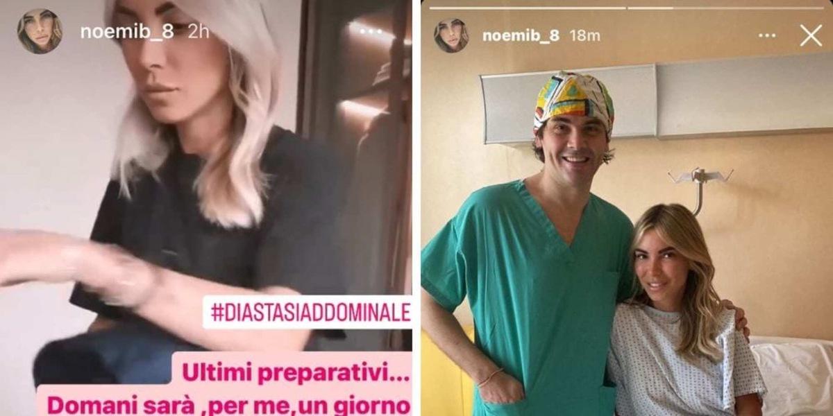 Noemi Bocchi e la diastasi, c'è l'operazione per la compagna di Totti: le sue parole