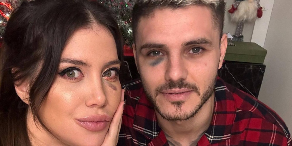 Dzeko e Icardi, rissa social per un occhio nero: "Piangono sempre, imbarazzanti"