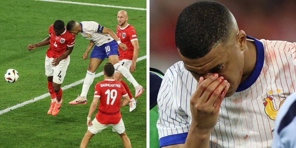 Danso alla Roma, ricordate cosa è successo con Mbappé all'Europeo? Le FOTO shock