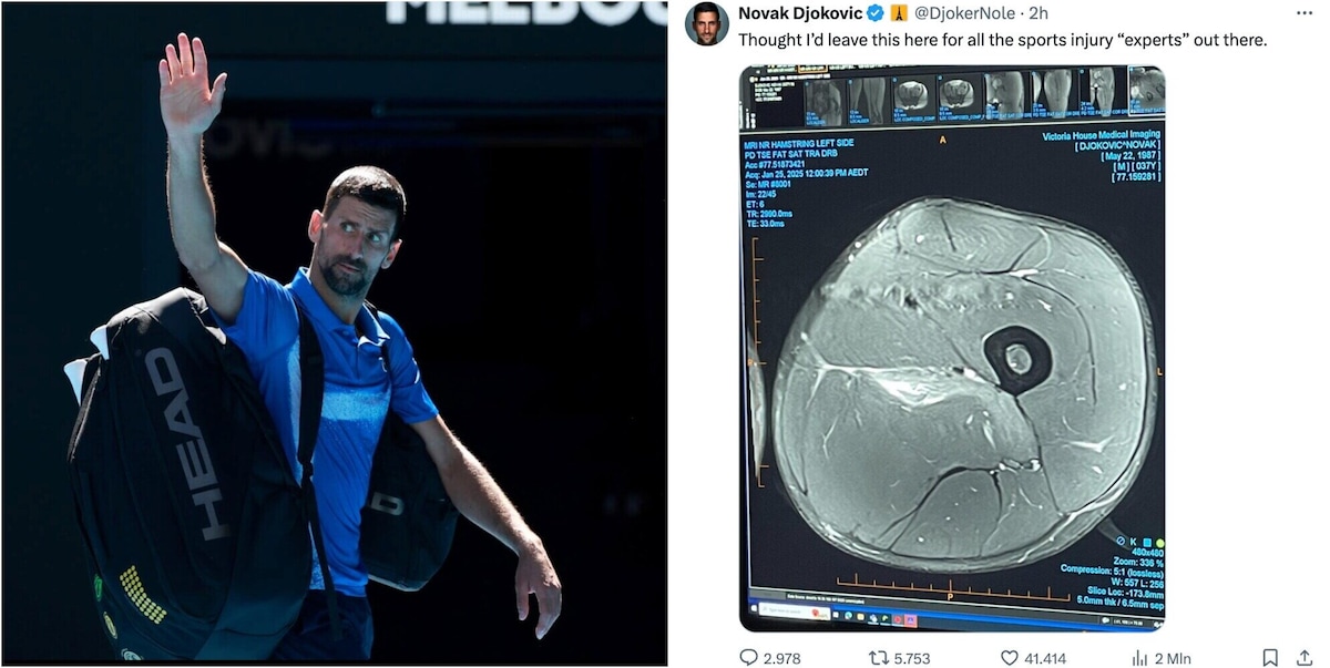 Djokovic mette le prove sui social, il gesto contro i critici: “Per gli esperti di infortuni”