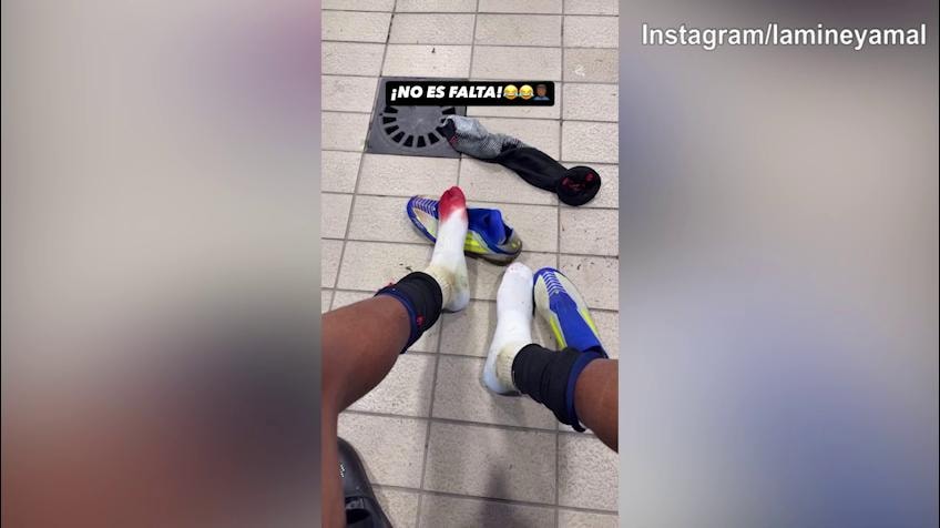 Barcellona, il piede insanguinato di Yamal e lui ironizza: "Non era fallo"