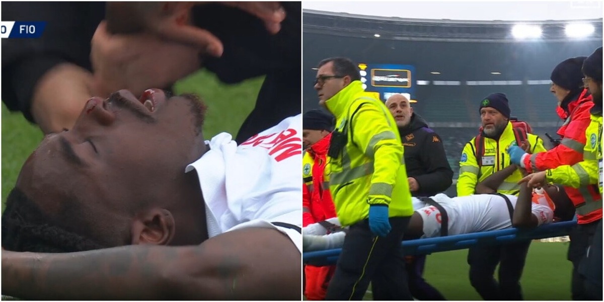 Kean è una maschera di sangue: esce in barella per trauma cranico. Il bollettino ufficiale