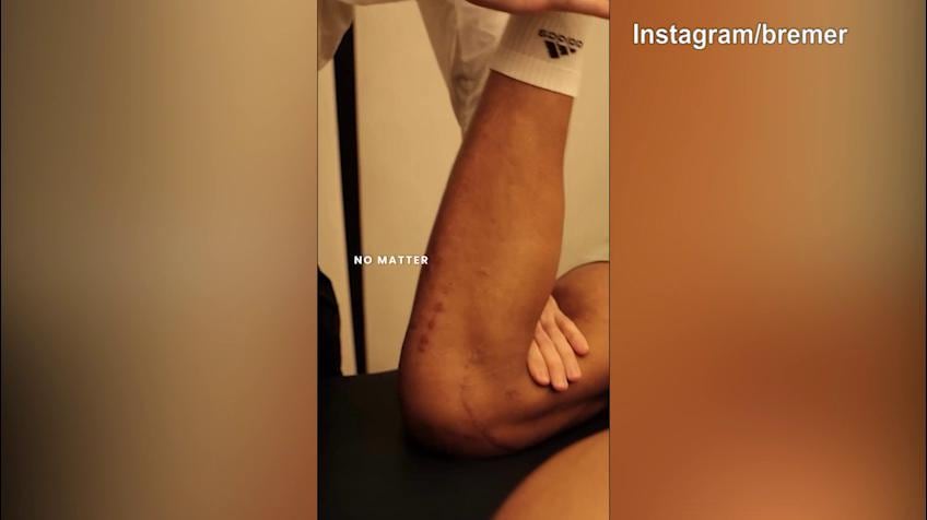 Juve, ancora Bremer: nuovi messaggi via social