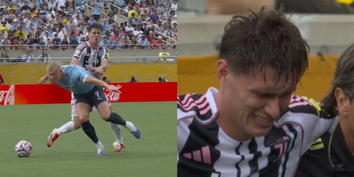 Infortunio per Savona in Juve-City: esce dal campo zoppicando