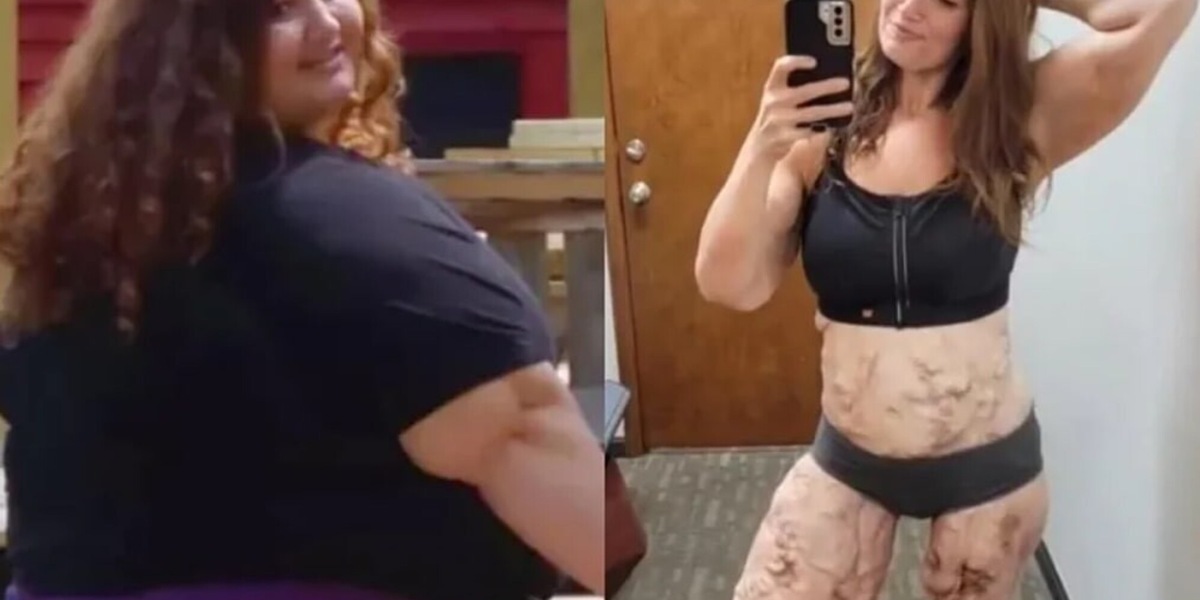 La battaglia di Lexi Reed, ha perso 140 chili e sfidato la morte