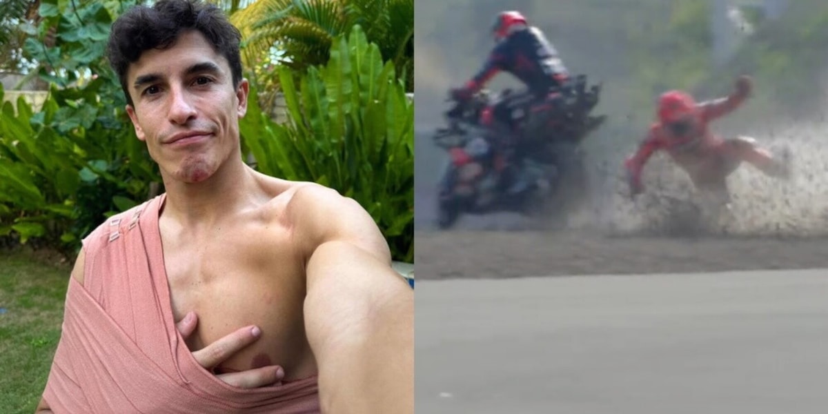 Marquez che sfortuna, frattura alla spalla confermata: quali gare salterà in MotoGp