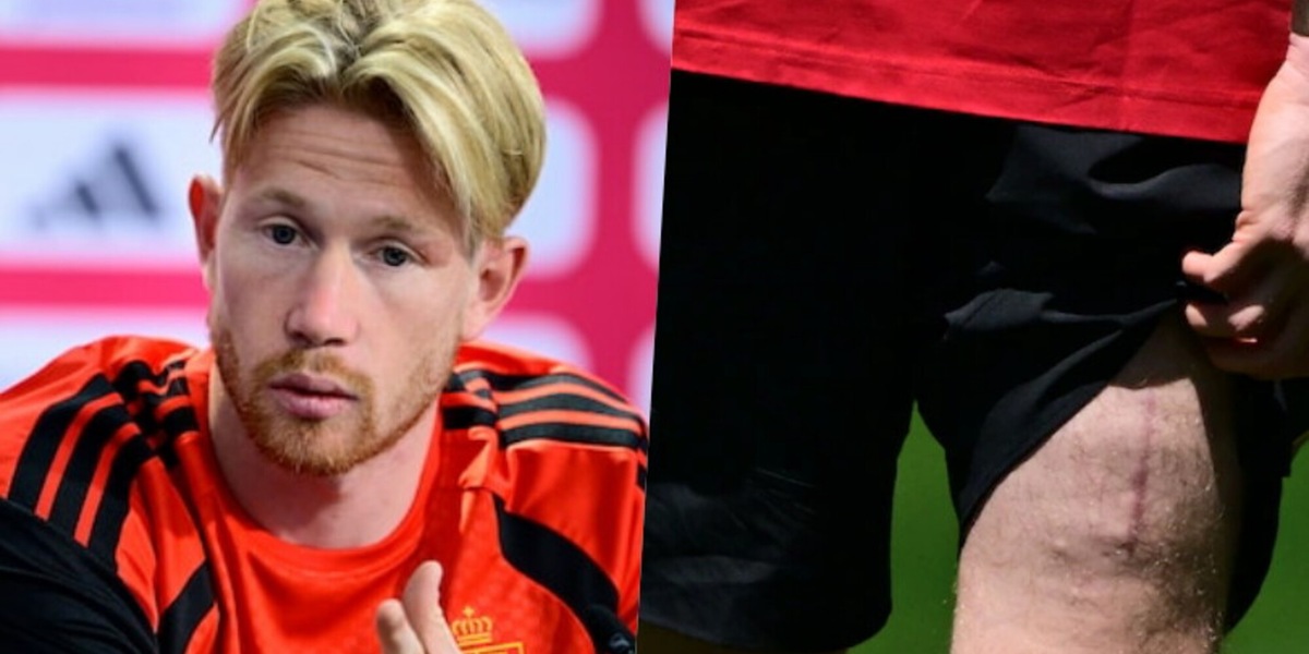 Tutte le verità di De Bruyne: il Napoli, Lukaku, il futuro e quella cicatrice...