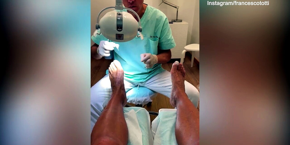 Totti si fa "bello" con la pedicure