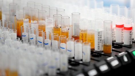 Servizi segreti Usa: "Coronavirus non creato in laboratorio"