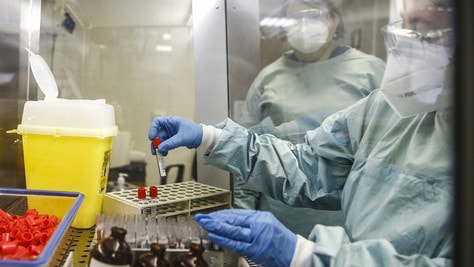 "Il Coronavirus sopravvive sulle superfici dai 3 secondi ai 2 minuti"