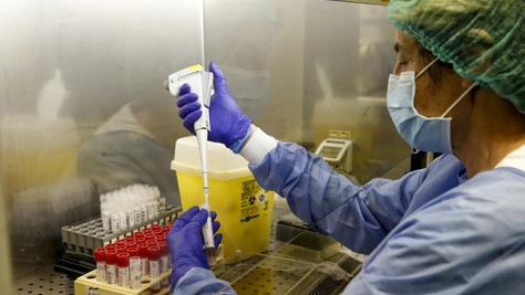 "Coronavirus clinicamente spento in Veneto"