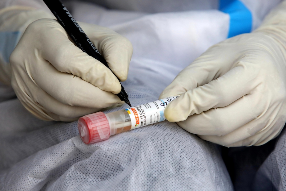 Clamoroso, guarisce dall'Aids senza trapianto