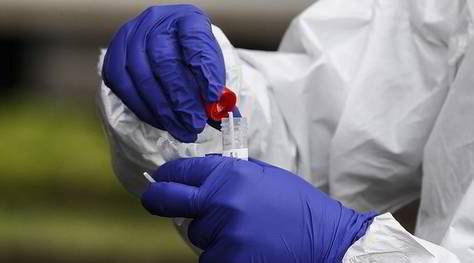 Coronavirus, tamponi e il falso positivo nel calcio