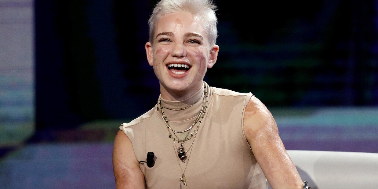 Bebe Vio esce allo scoperto con il nuovo fidanzato