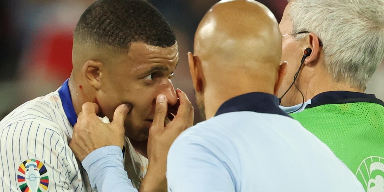 Mbappé shock: frattura al naso! Quante partite può saltare