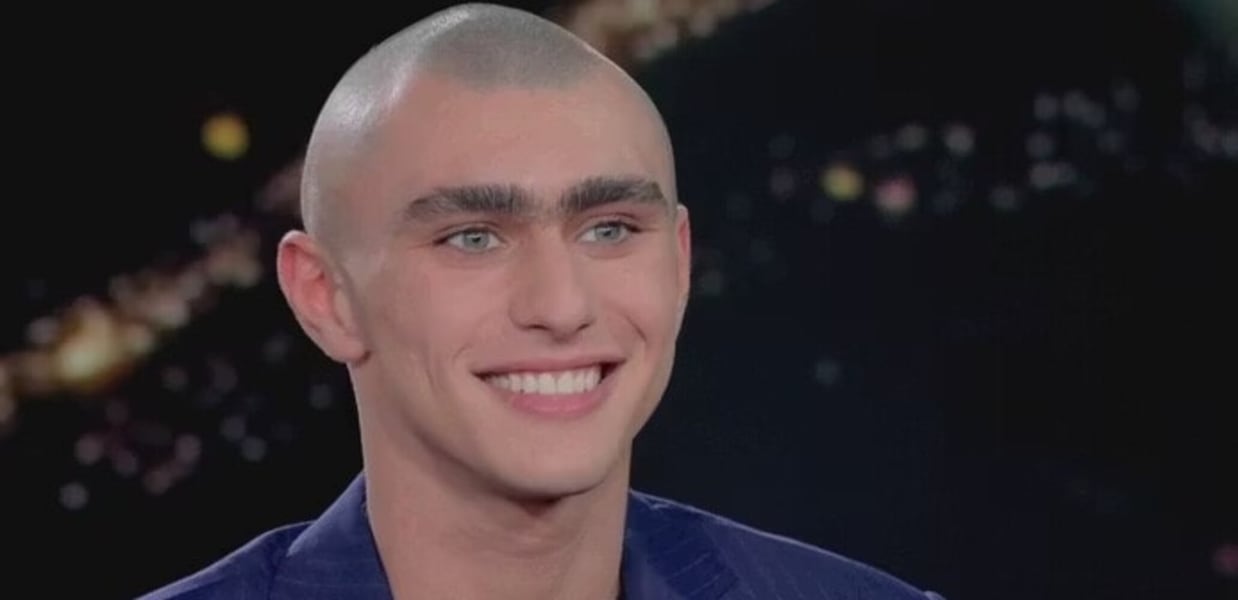 Il monociglio di Achille Costacurta fa discutere: "Lo toglierò ad una sola condizione"