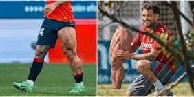 Ma che gamba hai? La foto del calciatore diventa virale sui social: svelata la sua identità e tutta la verità sul caso