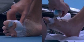 Le condizioni dei piedi fanno impressione: le telecamere pescano la sofferenza di Djokovic