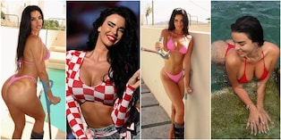 Ivana Knoll si infortuna a Mykonos: "Perone rotto ma sempre sexy"