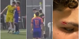 Testata a un giovane del Roma City sotto gli occhi dell'arbitro, ma niente espulsione VIDEO