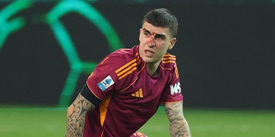 Mancini, intervento riuscito per la frattura al naso: dovrà indossare una maschera protettiva
