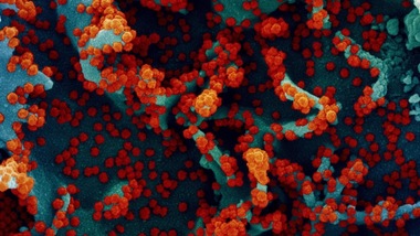 Coronavirus, preoccupano le varianti: quella del Regno Unito la più mortale