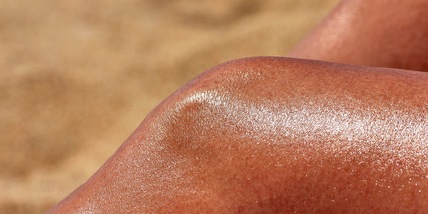 Né doposole né crema idratante: 5 rimedi naturali per scottature solari