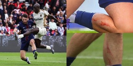 Psg, Kvaratskhelia esce per un brutto infortunio: sangue dal polpaccio, cosa è successo