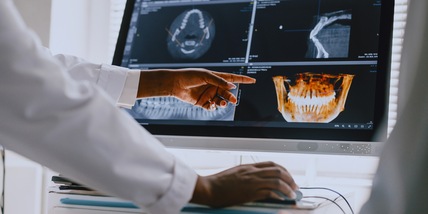 Staminali a gel rigenerano ossa e gengive, impianti più rapidi