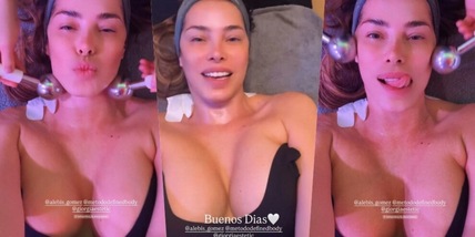 Aida Yespica, il trattamento al viso diventa sexy: social in delirio