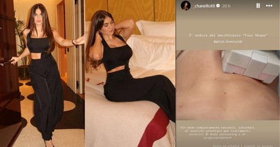 Come Chanel Totti rimodella il girovita senza interventi: il body contouring