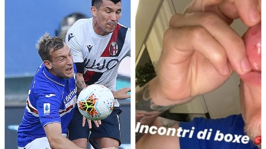 Sampdoria, La Gumina ironico sulla bocca ferita: "Incontri di boxe"